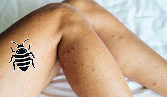 You Don't Have to Spend Another Night Being Eaten Alive